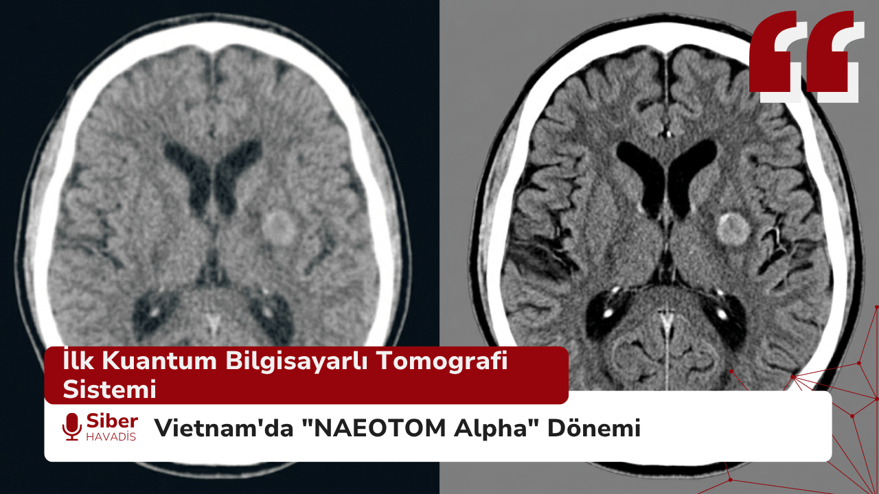 Vietnam’da “NAEOTOM Alpha” Dönemi